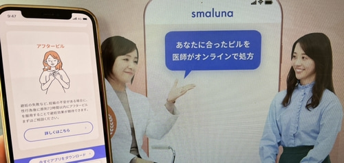 スマルナのアフターピル